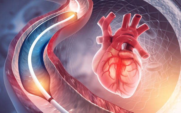 CT Angiography vascular imaging