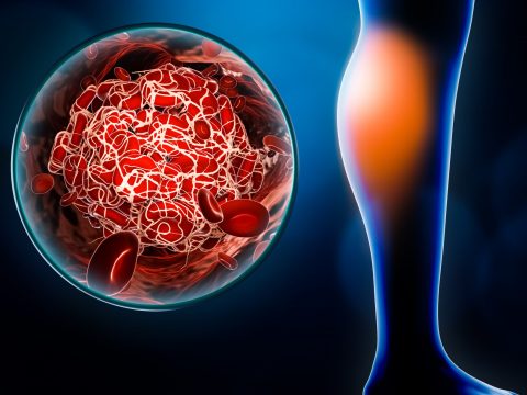 Peripheral vascular disease doctor in JP Nagar